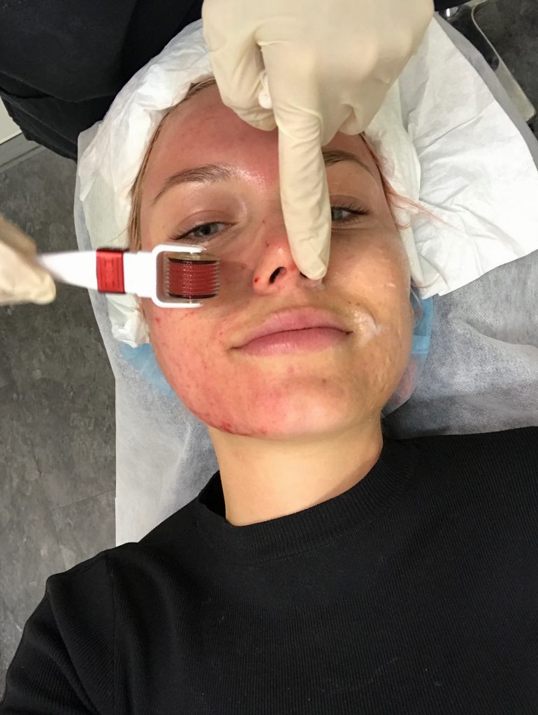 12F75B4A-AACA-4302-AF97-FB84081EF641